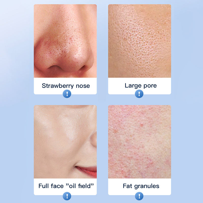 ORANGLES Ultrasonic Skin Scrubber – LCD Facial Deep Cleansing Machine - full product showcase - displaying specifications - Image 5 of 5 | adapts to any space | Ultrasonic Skin Scrubber – LCD Facial Deep Cleansing Machine deal New Jersey | Free Shipping ORANGLES